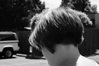 back-of-head-300x200.jpg