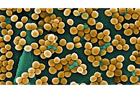 MRSA.jpg