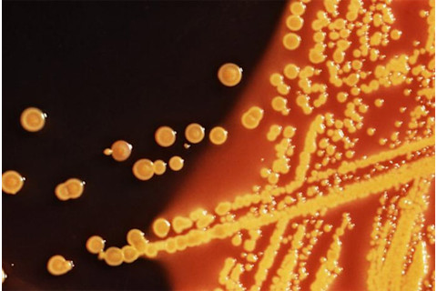 E.coli_.jpg