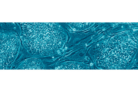 Embryonic-stem-cells.jpg
