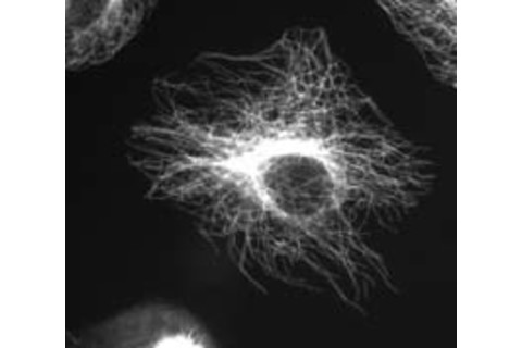 microtutubules_gel_fixated.jpg