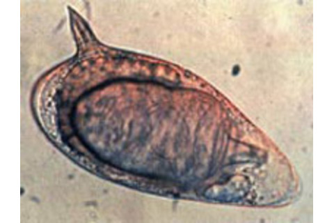 Schistosoma_mansoni.jpg