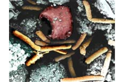 Anthrax_color_enhanced_micr.jpg