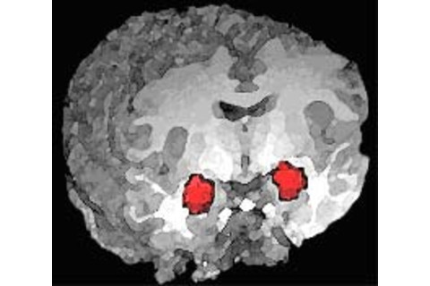 Amygdala_position.jpg