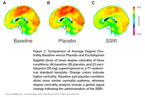 ssri_brain_schaefer.png