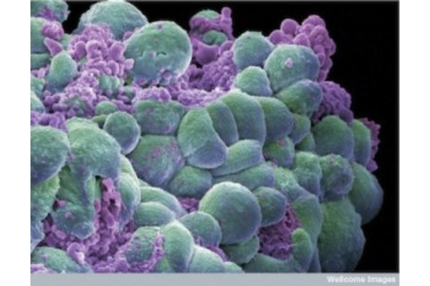 Cancer Cells