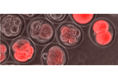 stem-cells.png