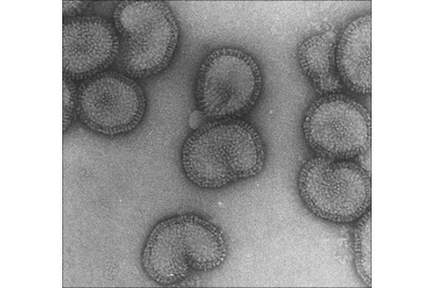 flu.jpg
