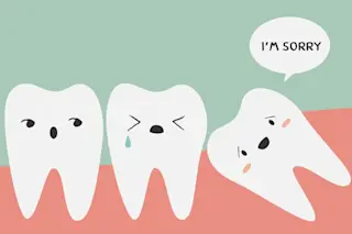 Wisdom Teeth - Shutterstock