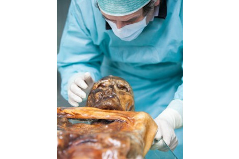 otzi_2-237x300.jpg