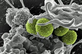 MRSA.jpg
