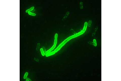Yersinia_pestis_fluorescent-1024x1012.jpeg
