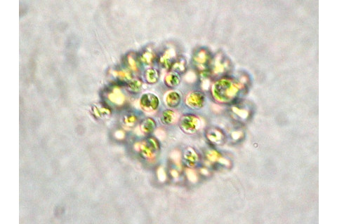 Microcystis_aeruginosa.jpeg