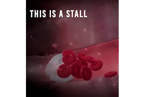 Stall Catchers Movie Still