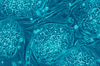 stemcells.jpg