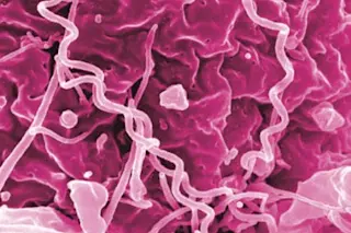 Syphilis_Bacteria_16842837731.jpg