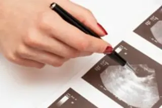 ovary-ultrasound.jpg