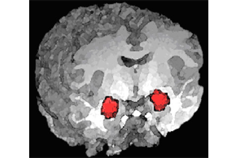 Amygdala_position.png