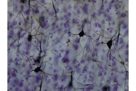 neuron-425x318.jpg