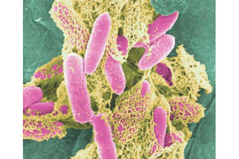 ecoli.jpg