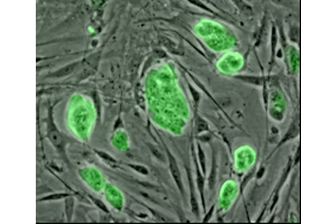 stemcell-425x359.jpg
