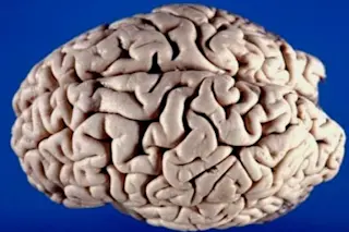 brain-425x289.jpg
