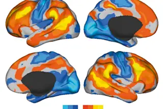 brain-variation.jpg