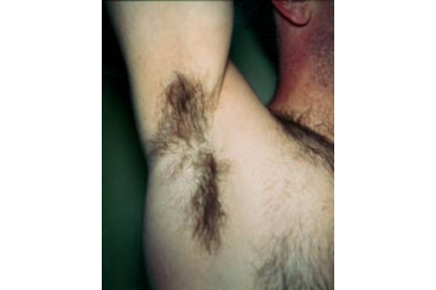 armpit.jpg