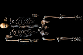 Well Man Skeleton