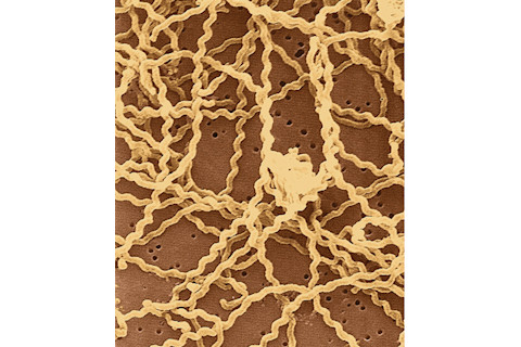 Leptospirosis - Science Source - 7_DSC-VS0517_02.jpg