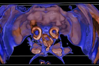 beectscan.jpg