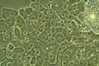 liver-250.jpg