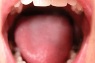 tongue.jpg
