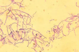 anthrax.jpg