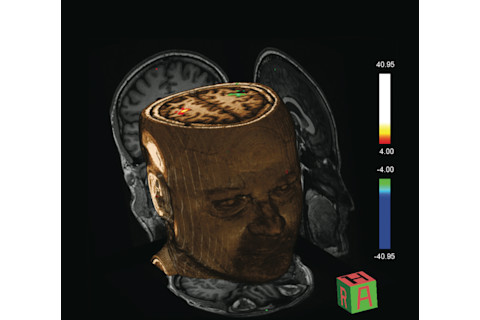 Functional-MRI.png