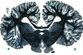 dolphin-brain.jpg