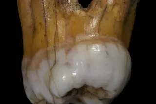 molar.jpg