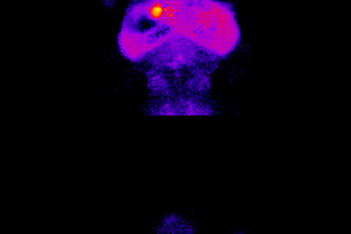 zebrafish-neurons.png