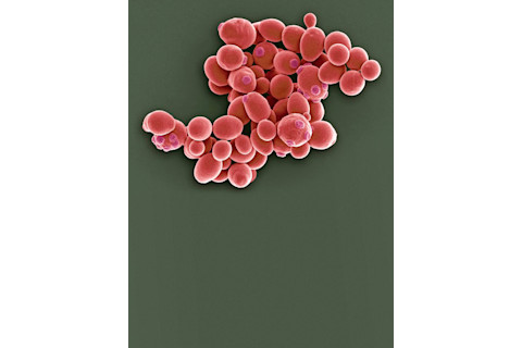 saccharomyces-cerevisiae.jpg