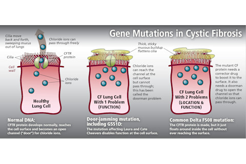 Gene Mutations in Cystic Fibrosis - Jay Smith