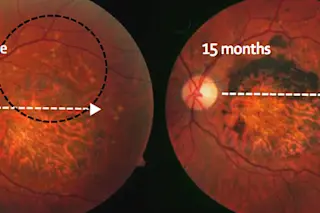 retinas.jpg