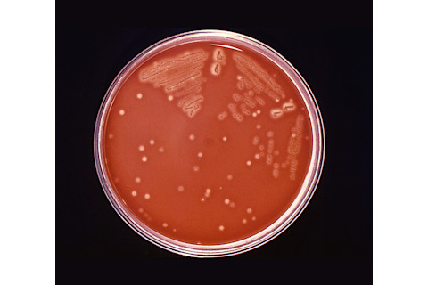 strep-colonies.jpg