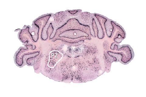 brain-cross-section.jpg