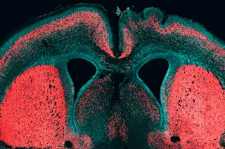 brain-gene.jpg