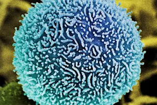 Pancreatic Cancer Cell - Science Source - DSC-BI1016_02.jpg