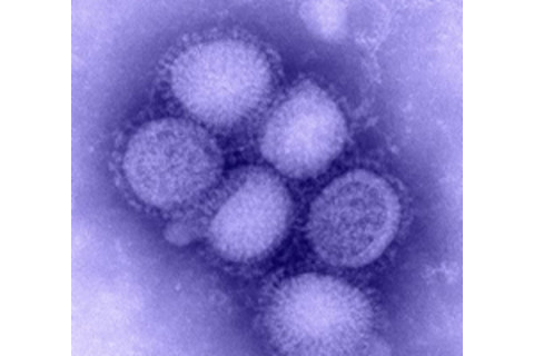 swine-flu-virus1.jpg