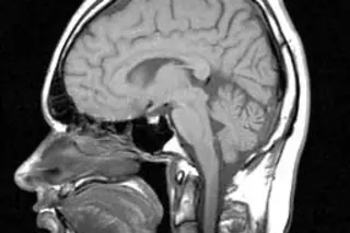 MRI_head_side.jpg