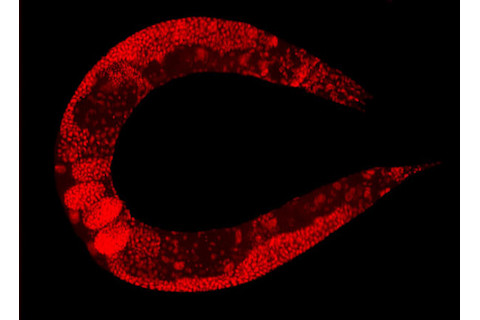 C_elegans_stained.jpg