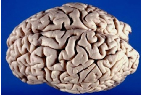 Brain_300.jpg