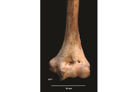 Humerus.